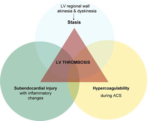 lv thrombus bridging|lv thrombus after heart attack.